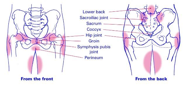 pelvic girdle pain diagram