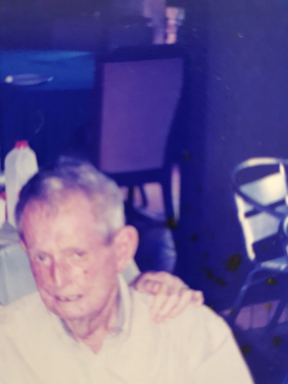 Michael Mullins with Scleroderma and its affect on the face.